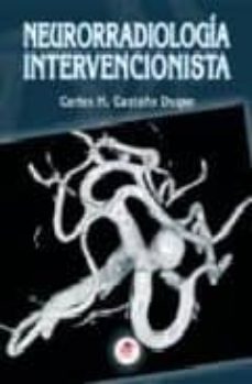 Neurorradiologia Intervencionista