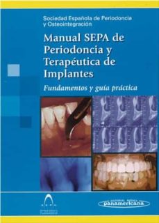 Manual Sepa De Periodoncia Y Terapeutica De Implantes: Fundamento S Y Guia Practica