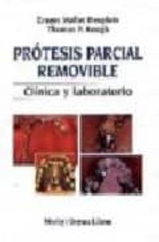 Protesis Parcial Removible: Clinica Y Laboratorio