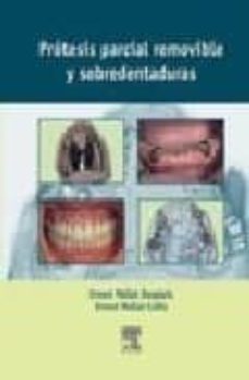 Protesis Parcial Removible Y Sobredentaduras