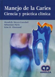 Libro, Audiolibro Manejo De La Caries: Ciencia Y Practica Clinica Manejo De La Caries: Ciencia Y Practica Clinica